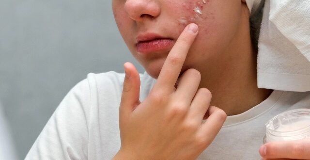 akmi_proionta_gynaika