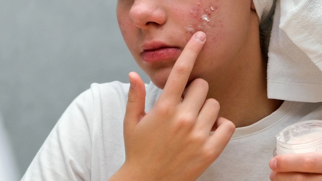 akmi_proionta_gynaika