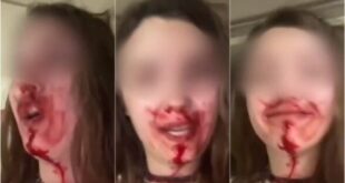 gynaika-endooikogeniaki-via